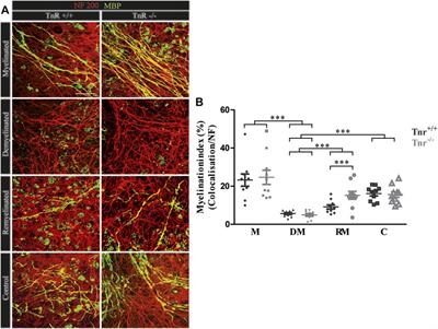 Tenascins Interfere With Remyelination in an Ex Vivo Cerebellar Explant Model of Demyelination